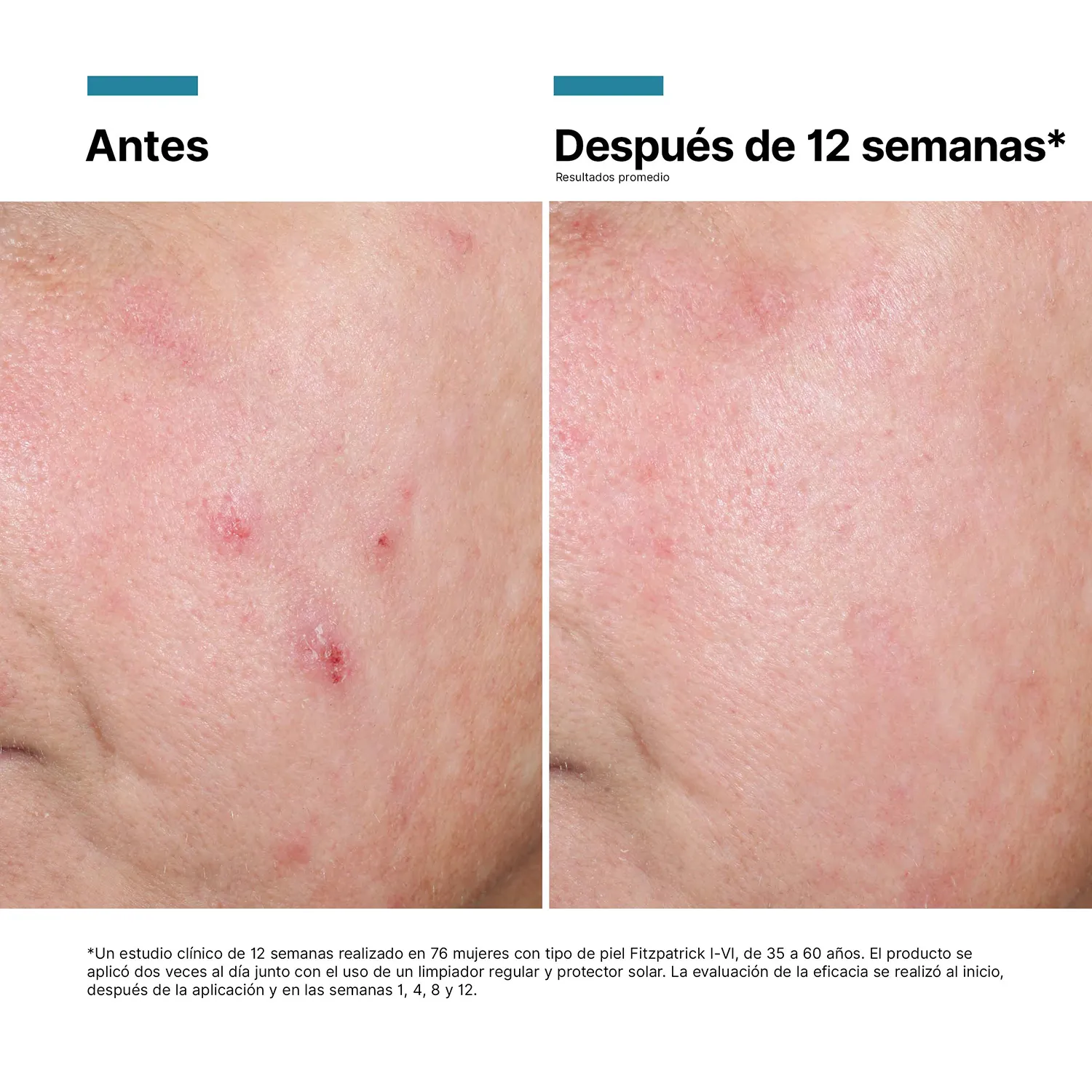 SkinCeuticals Crema Regeneradora Advanced RGN-6 50ml - Imagen 9