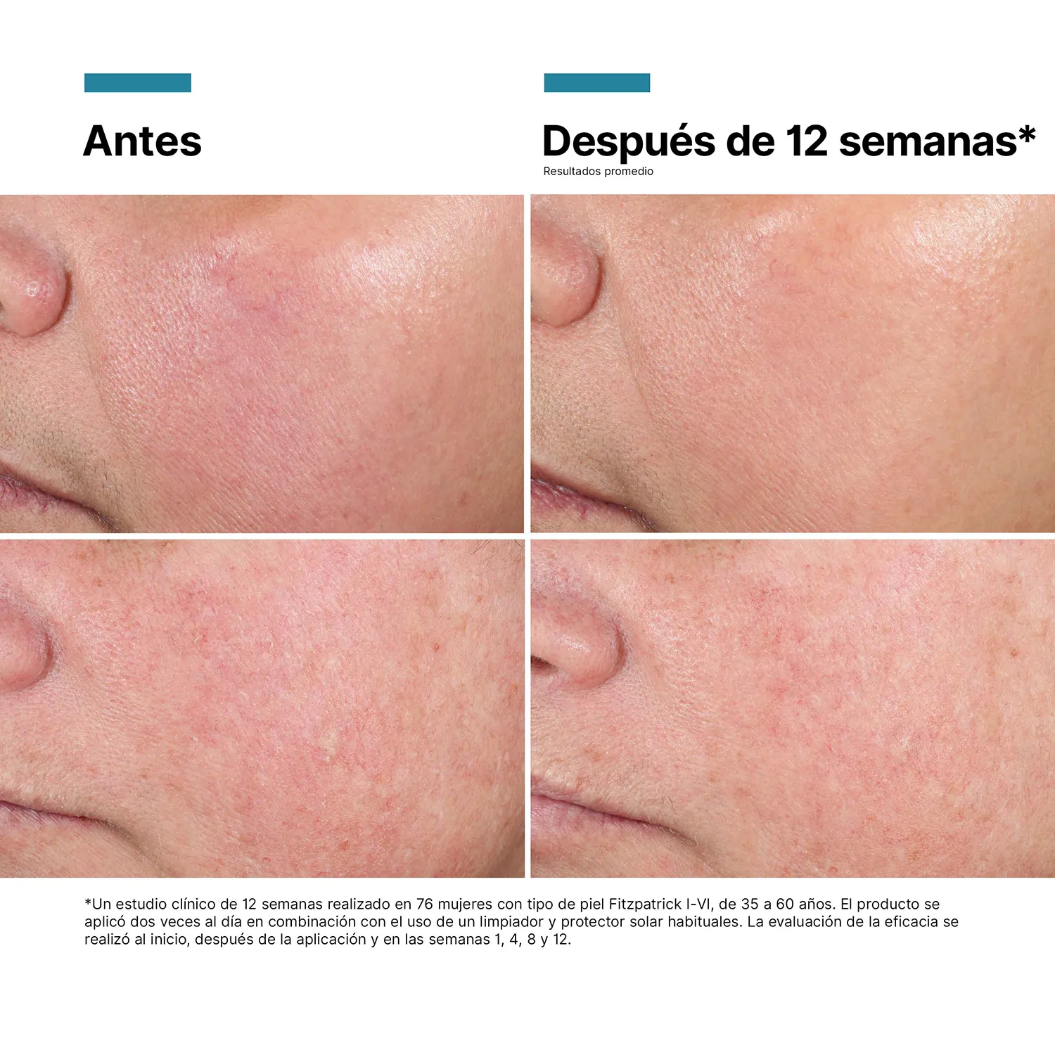 SkinCeuticals Crema Regeneradora Advanced RGN-6 50ml - Imagen 10